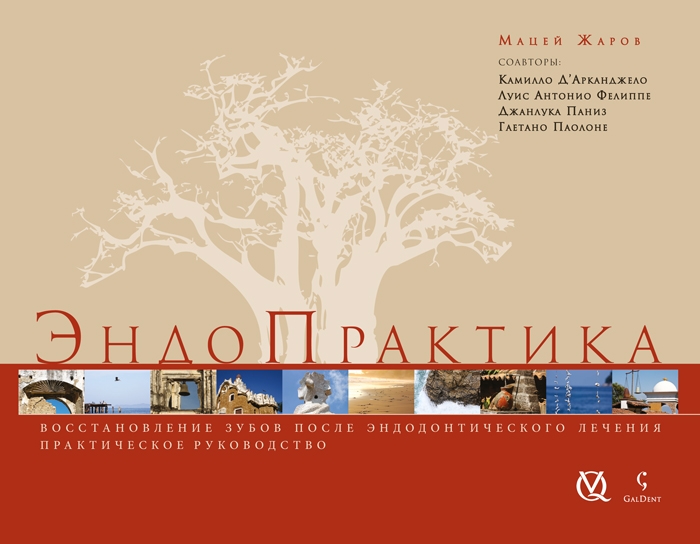 Ишиас симптомы лечение гимнастикой